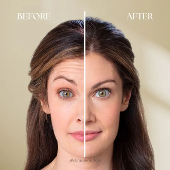 Celimax Retinol Skin Tightening Booster Cream (Tighten, Tone up & Instant brighten Skin - Guaranteed results)